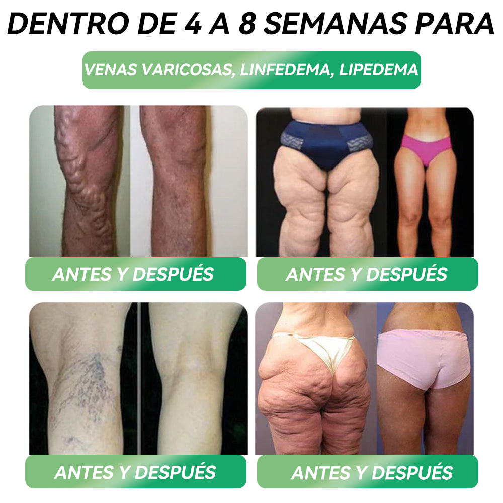 🔥Tienda Oficial | 𝙃𝐻𝑉𝖡®✨𝑺𝒐𝒍𝒖𝒄𝒊ó𝒏 𝒐𝒓𝒂𝒍 𝒍í𝒒𝒖𝒊𝒅𝒂 𝑮𝑳𝑷-1 𝒔𝒆𝒊𝒔 𝒆𝒏 𝒖𝒏𝒐 (Solo una dosis al día, cambios visibles en 7 días) 🌿 Para obesidad, salud cardiovascular, diabetes, apnea del sueño, problemas articulares y más
