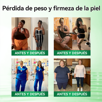🇪🇸𝑻𝒊𝒆𝒏𝒅𝒂 𝑶𝒇𝒊𝒄𝒊𝒂𝒍 | 🍏🍏𝑮𝑳𝑶𝑹𝑬𝐍𝐃𝗔®𝗠𝗼𝗿𝙞𝙣𝙜𝙖 · 𝘽𝙚𝙧𝙗𝙚𝙧𝙞𝙣𝒂 × 𝑵𝑨𝐃+ 𝐏𝐚𝐫𝐜𝙝𝙚 𝘼𝙫𝙖𝙣𝙯𝙖𝙙𝗼 𝗱𝗲 𝗠𝗶𝗰𝗿𝗼𝒏𝒂𝒍𝒈𝒂 𝑵𝒂𝐧𝐨 𝟏0-𝙚𝙣-1(𝐒𝐨𝐥𝐨 𝐮𝐧𝐚 𝐯𝐞𝐳 𝐚𝐥 𝐝í𝐚） ✅ 𝐏𝐚𝐫𝐚 𝐥𝐚 𝐨𝐛𝐞𝐬𝐢𝐝𝐚𝐝, 🅟🅘🅔🅛 🅕🅛🅐🅒🅘🅓🅐, 𝐝𝐢𝐚𝐛𝐞𝐭𝐞𝐬, 𝐚𝐩𝐧𝐞𝐚 𝐝𝐞𝐥 𝐬𝐮𝐞ñ𝐨, 𝐩𝐫𝐨𝐛𝐥𝐞𝐦𝐚𝐬 𝐚𝐫𝐭𝐢𝐜𝐮𝐥𝐚𝐫𝐞𝐬, 𝐲 𝐦𝐮𝐜𝐡𝐨 𝐦á𝐬🎁